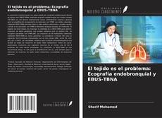 Buchcover von El tejido es el problema: Ecografía endobronquial y EBUS-TBNA