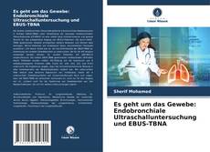 Couverture de Es geht um das Gewebe: Endobronchiale Ultraschalluntersuchung und EBUS-TBNA