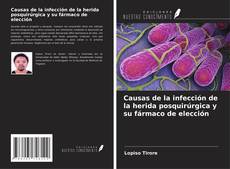 Capa do livro de Causas de la infección de la herida posquirúrgica y su fármaco de elección 