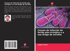 Bookcover of Causas da infecção da ferida pós-cirúrgica e a sua droga de escolha