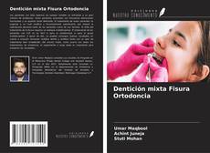 Bookcover of Dentición mixta Fisura Ortodoncia