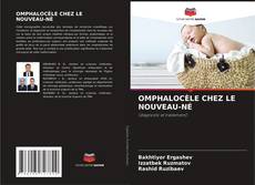 Buchcover von OMPHALOCÈLE CHEZ LE NOUVEAU-NÉ