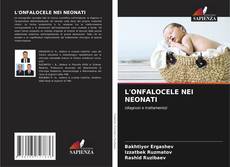Buchcover von L'ONFALOCELE NEI NEONATI