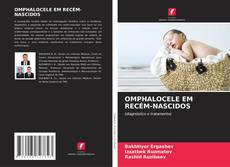 Bookcover of OMPHALOCELE EM RECÉM-NASCIDOS