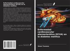 Enfermedad cardiovascular aterosclerótica (ECVA) en la diabetes mellitus kitap kapağı