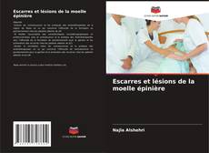 Bookcover of Escarres et lésions de la moelle épinière