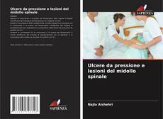 Buchcover von Ulcere da pressione e lesioni del midollo spinale