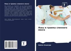 Bookcover of Язвы и травмы спинного мозга