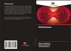 Buchcover von Métastases