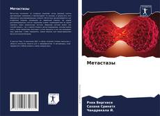 Bookcover of Метастазы