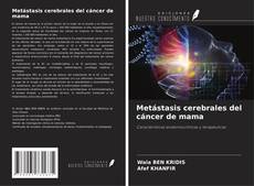 Buchcover von Metástasis cerebrales del cáncer de mama