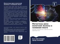 Couverture de Метастазы рака молочной железы в головном мозге