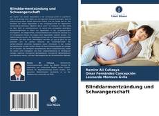 Blinddarmentzündung und Schwangerschaft的封面