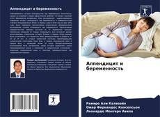 Buchcover von Аппендицит и беременность