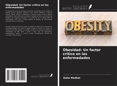 Bookcover of Obesidad: Un factor crítico en las enfermedades