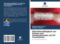 Buchcover von Überlebensfähigkeit von Kronen und Verblendschalen auf ET-Frontzähnen