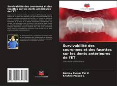 Capa do livro de Survivabilité des couronnes et des facettes sur les dents antérieures de l'ET 