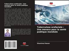 Buchcover von Tuberculose orofaciale : Une menace pour la santé publique mondiale