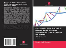Обложка Estudo do ATM & Chek2 Genes SNPS & a sua associação com o cancro da mama