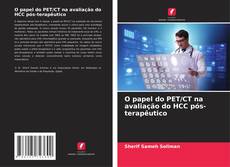 Couverture de O papel do PET/CT na avaliação do HCC pós-terapêutico