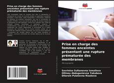 Bookcover of Prise en charge des femmes enceintes présentant une rupture prématurée des membranes
