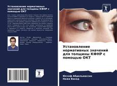 Buchcover von Установление нормативных значений для толщины КФНР с помощью ОКТ