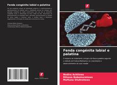 Bookcover of Fenda congénita labial e palatina