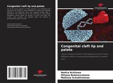 Congenital cleft lip and palate kitap kapağı
