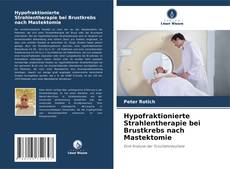 Copertina di Hypofraktionierte Strahlentherapie bei Brustkrebs nach Mastektomie