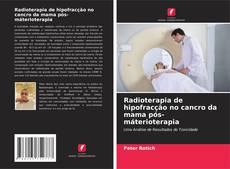 Radioterapia de hipofracção no cancro da mama pós-máterioterapia kitap kapağı