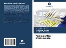 Bookcover of Periimplantäre Erkrankungen