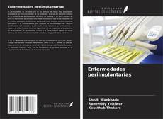 Buchcover von Enfermedades periimplantarias