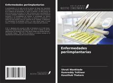 Capa do livro de Enfermedades periimplantarias 