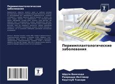 Copertina di Периимплантологические заболевания