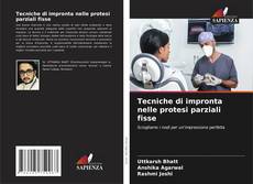 Bookcover of Tecniche di impronta nelle protesi parziali fisse