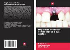 Implantes dentários: complicações e sua gestão kitap kapağı