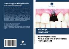 Bookcover of Zahnimplantate: Komplikationen und deren Management