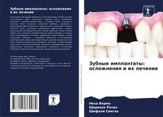 Capa do livro de Зубные имплантаты: осложнения и их лечение 