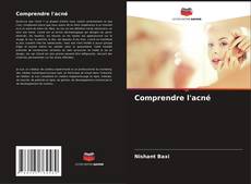 Bookcover of Comprendre l'acné