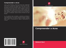 Compreender a Acne的封面