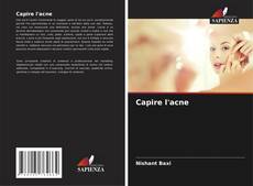 Capa do livro de Capire l'acne 