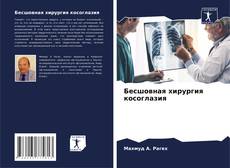 Capa do livro de Бесшовная хирургия косоглазия 