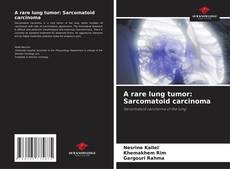 Portada del libro de A rare lung tumor: Sarcomatoid carcinoma