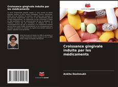 Bookcover of Croissance gingivale induite par les médicaments