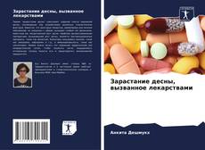 Copertina di Зарастание десны, вызванное лекарствами