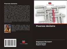 Fluorose dentaire kitap kapağı