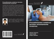 Bookcover of Procedimientos estéticos faciales mínimamente invasivos