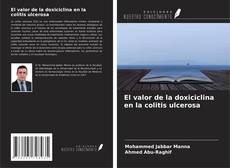 Bookcover of El valor de la doxiciclina en la colitis ulcerosa