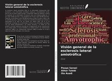 Visión general de la esclerosis lateral amiotrófica kitap kapağı
