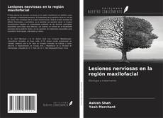 Buchcover von Lesiones nerviosas en la región maxilofacial